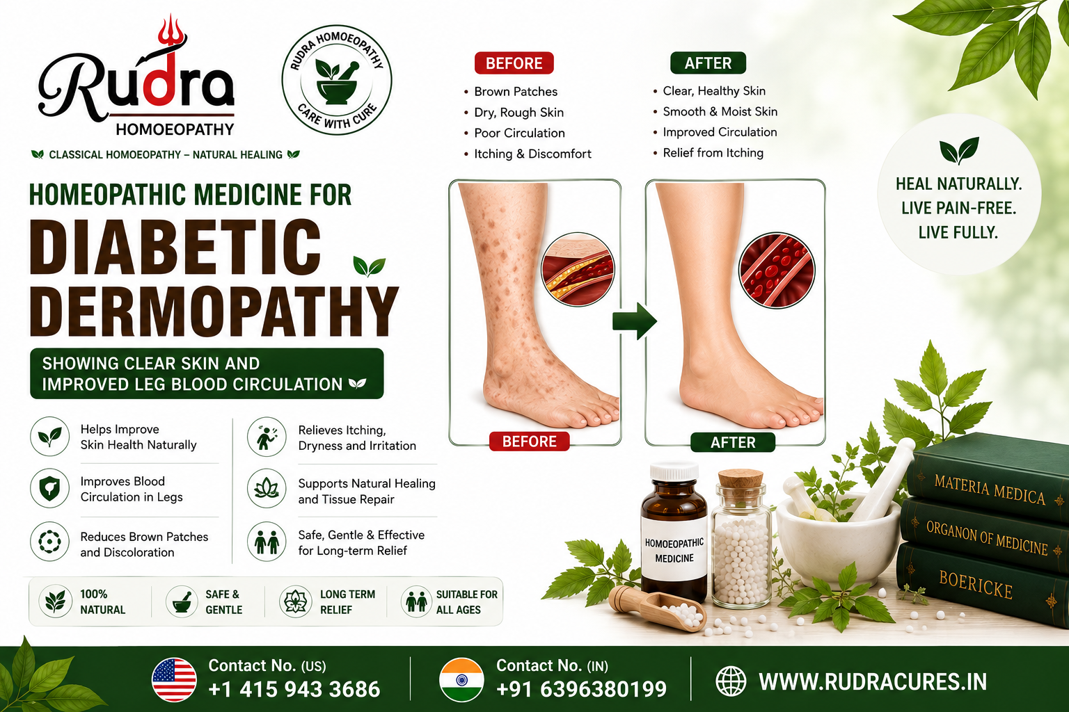 Homeopathic remedies for diabetic shin spots, skin hyperpigmentation, microvascular damage, and blood sugar control