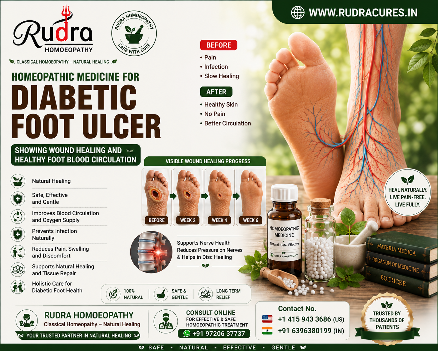 Homeopathic remedies for diabetic neuropathy, peripheral vascular disease, gangrene prevention, and foot ulcer recovery